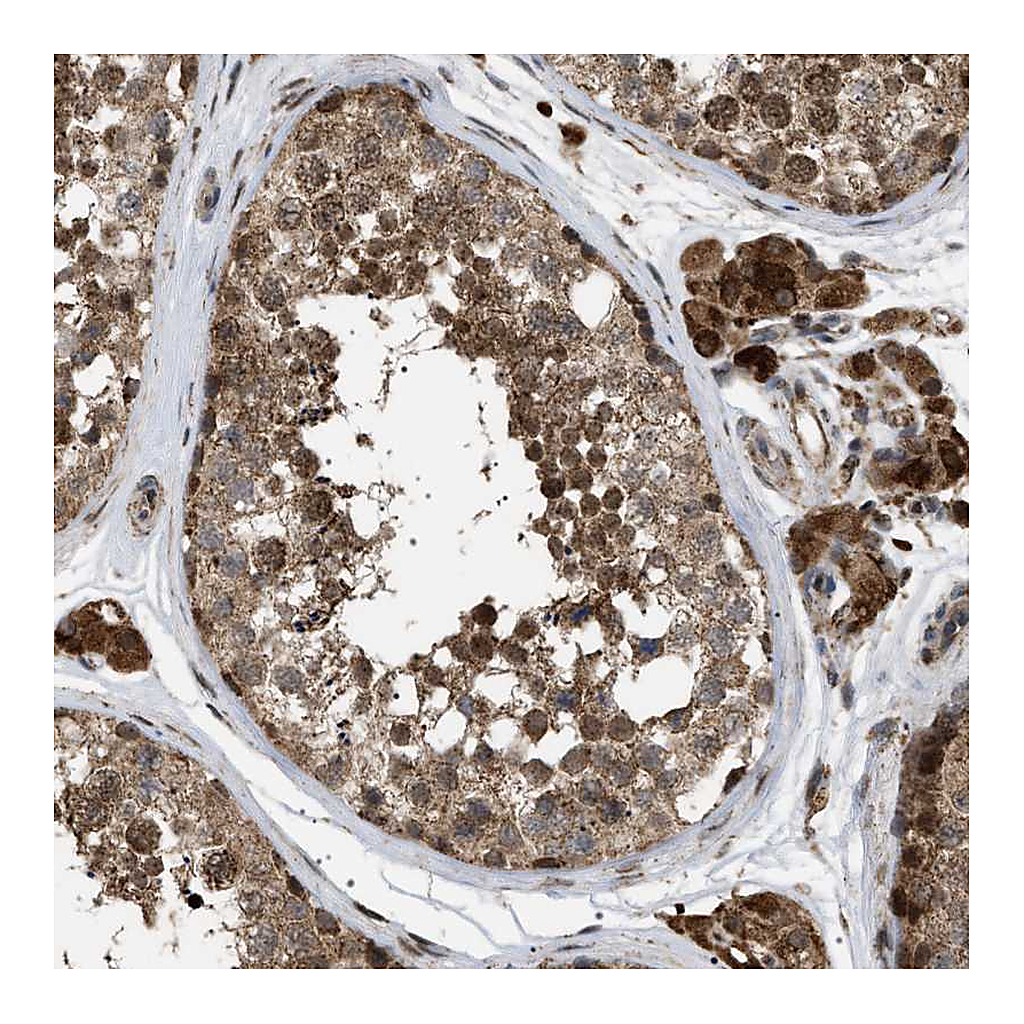 Atlas Antibodies Anti-MELK Antibody