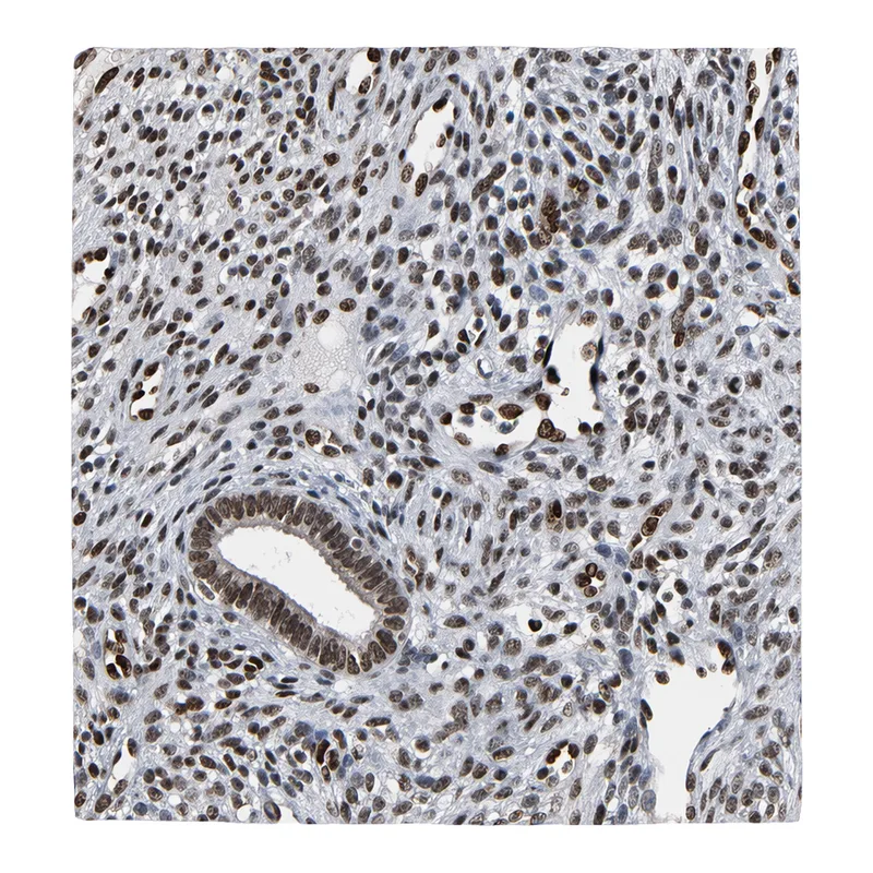 Atlas Antibodies Anti-MEIS2 Antibody