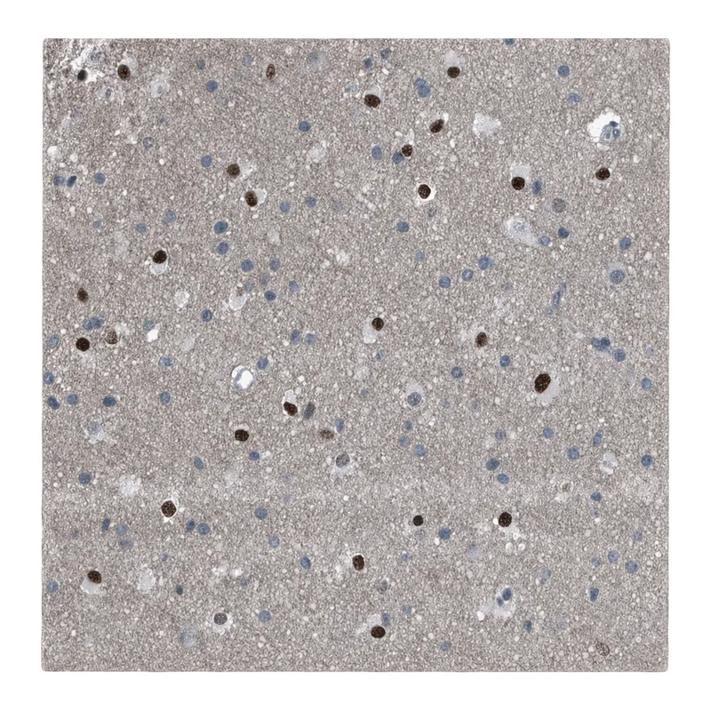 Atlas Antibodies Anti-MEN1 Antibody
