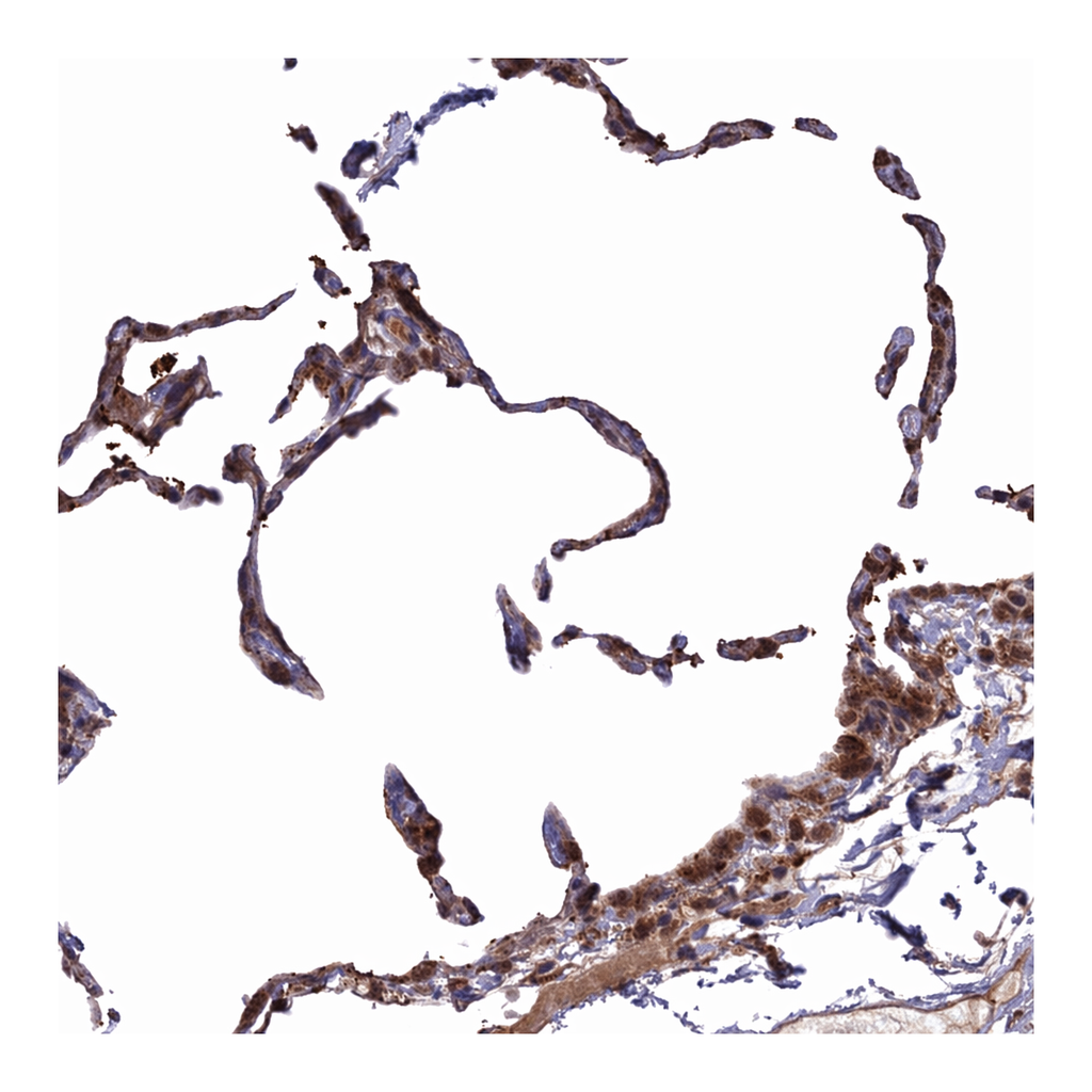 Atlas Antibodies Anti-MEOX1 Antibody