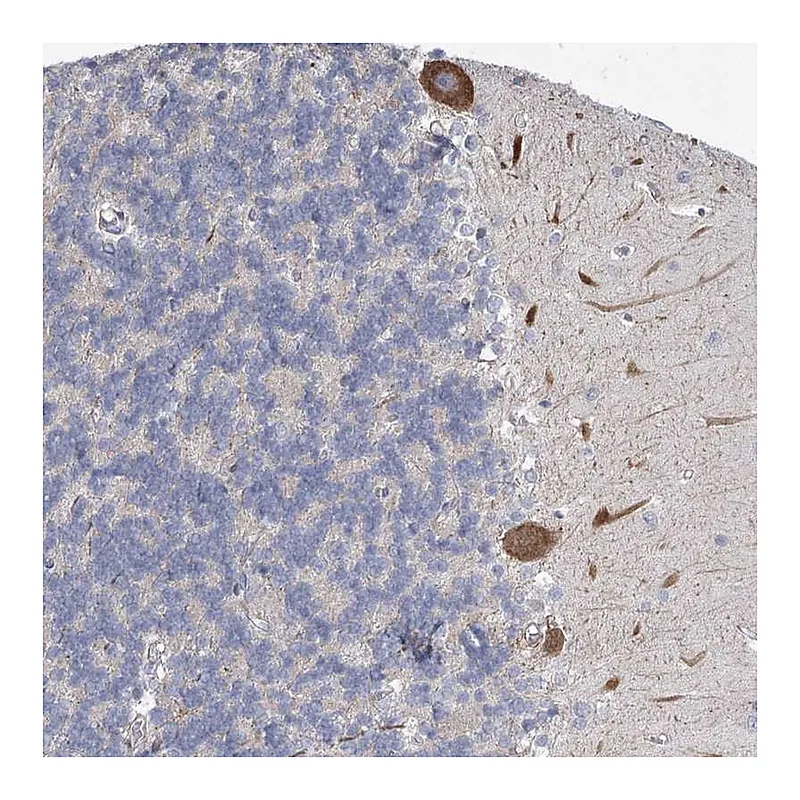 Atlas Antibodies Anti-MEPE Antibody