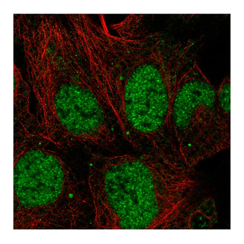 Atlas Antibodies Anti-MESDC1 Antibody