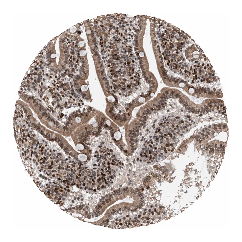 Atlas Antibodies Anti-MESDC2 Antibody