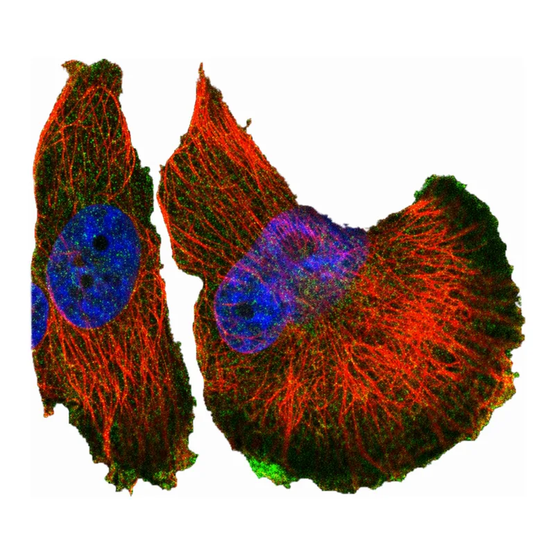 Atlas Antibodies Anti-MET Antibody