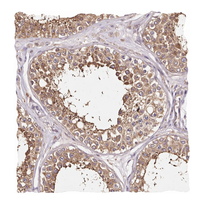 Atlas Antibodies Anti-METAP1 Antibody