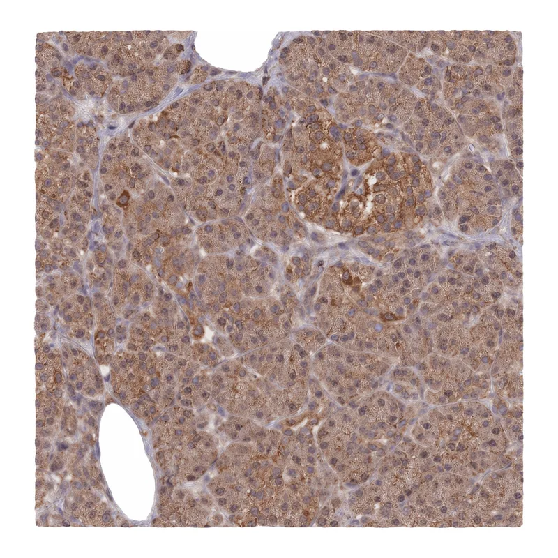 Atlas Antibodies Anti-METRN Antibody