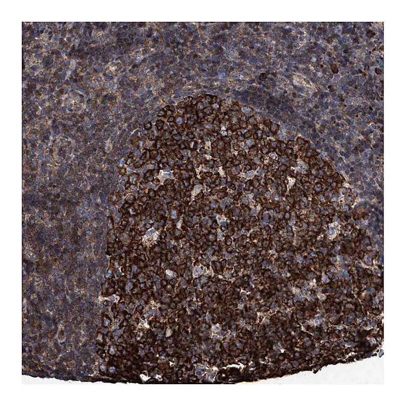 Atlas Antibodies Anti-METAP2 Antibody