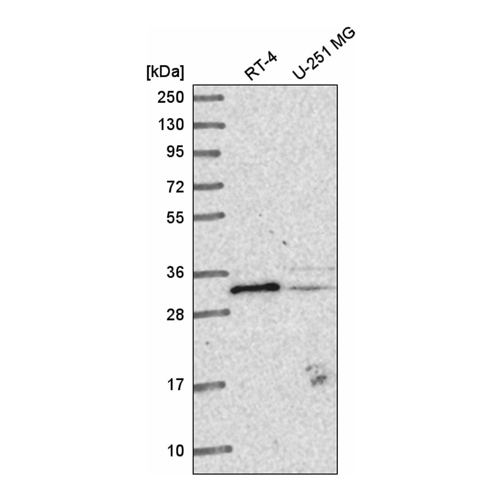 Atlas Antibodies Anti-METTL1 Antibody