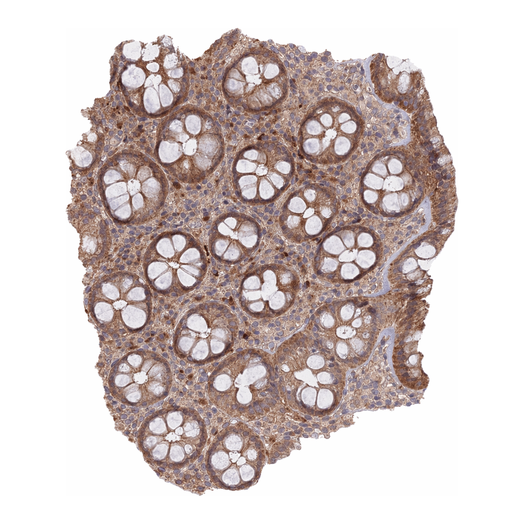 Atlas Antibodies Anti-METTL13 Antibody
