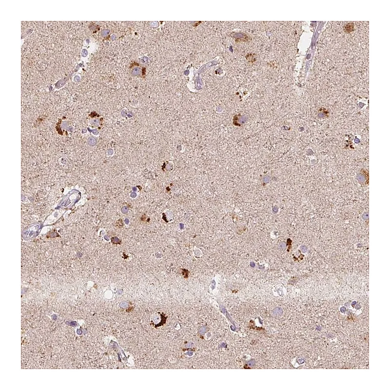 Atlas Antibodies Anti-METTL13 Antibody
