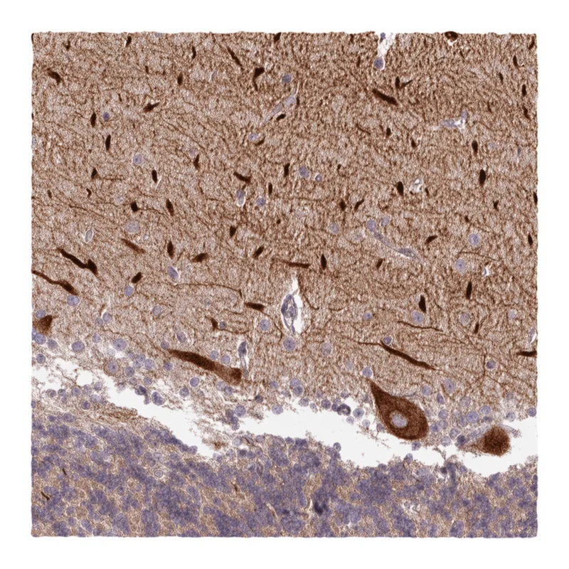 Atlas Antibodies Anti-METTL17 Antibody