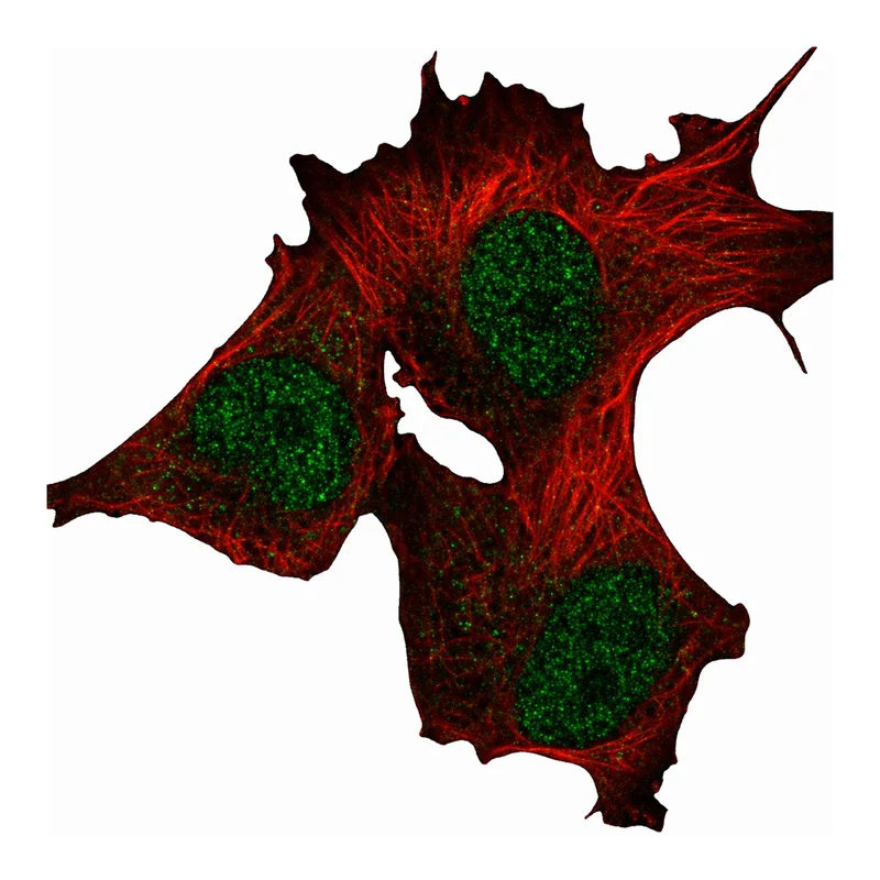 Atlas Antibodies Anti-METTL16 Antibody