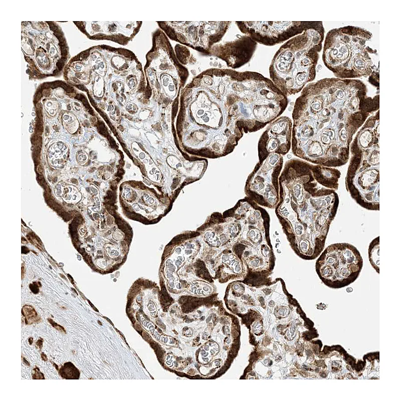 Atlas Antibodies Anti-METTL21A Antibody