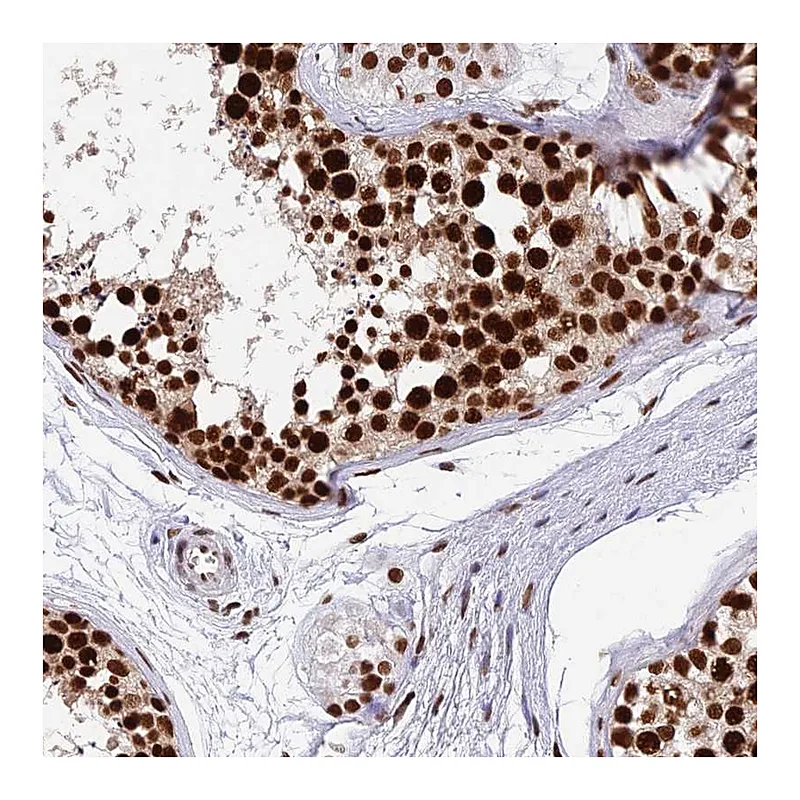 Atlas Antibodies Anti-METTL21B Antibody