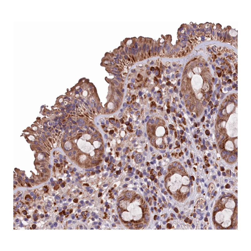 Atlas Antibodies Anti-METTL22 Antibody