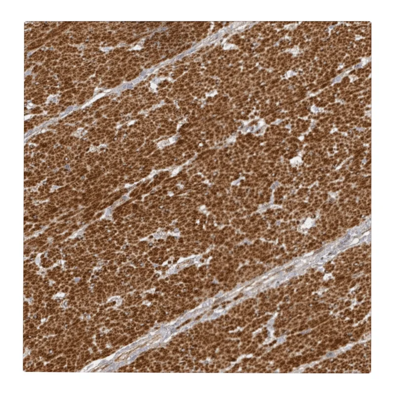 Atlas Antibodies Anti-METTL22 Antibody