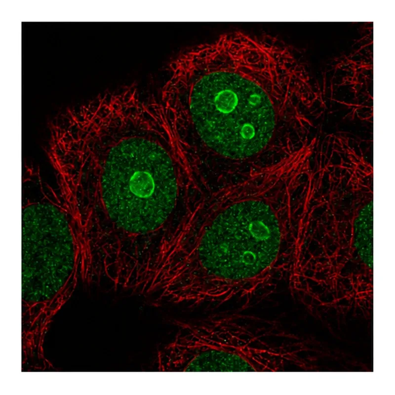 Atlas Antibodies Anti-METTL22 Antibody