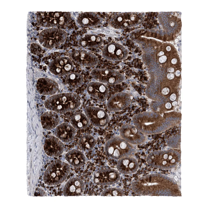 Atlas Antibodies Anti-METTL24 Antibody
