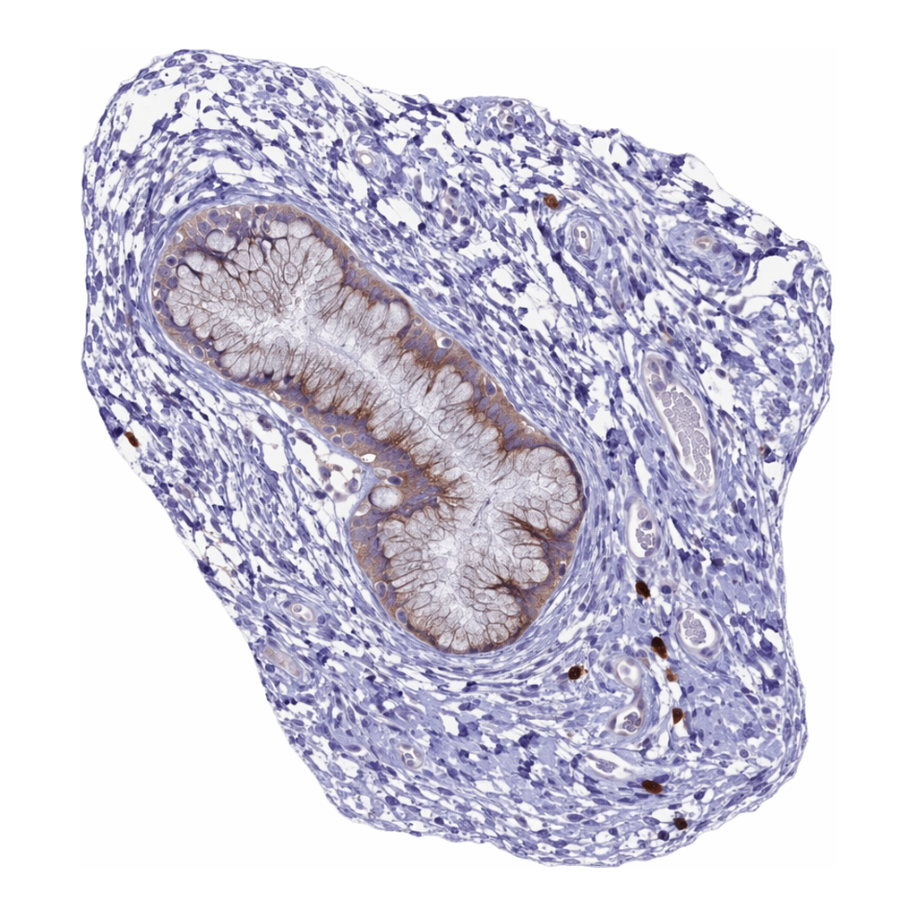 Atlas Antibodies Anti-METTL25 Antibody