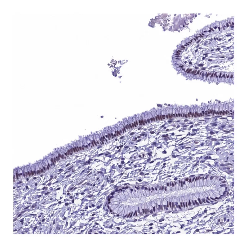 Atlas Antibodies Anti-METTL25 Antibody