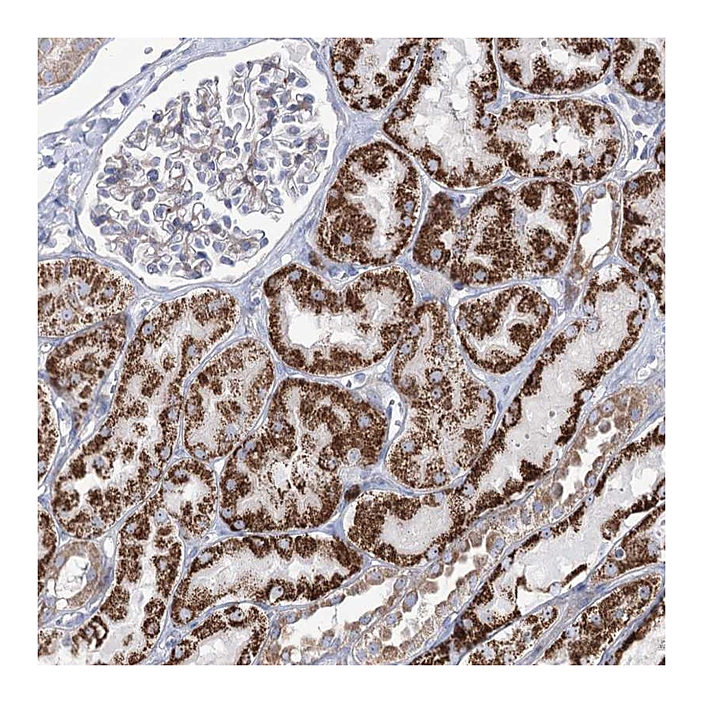 Atlas Antibodies Anti-METTL5 Antibody