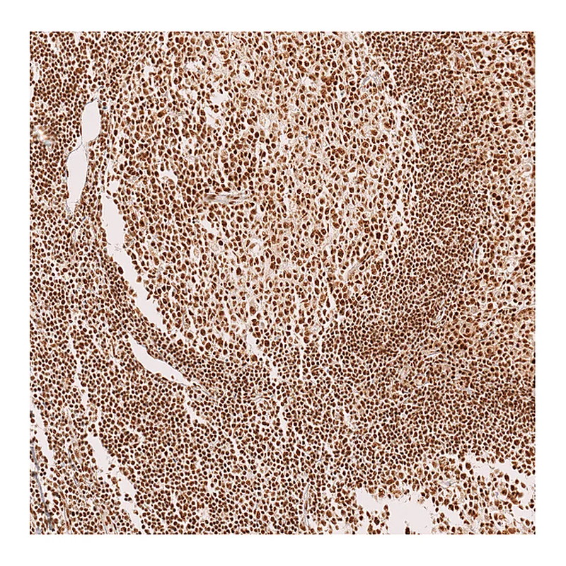 Atlas Antibodies Anti-METTL4 Antibody