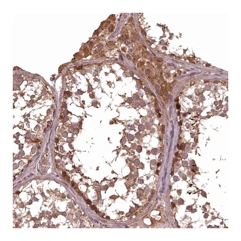 Atlas Antibodies Anti-METTL4 Antibody