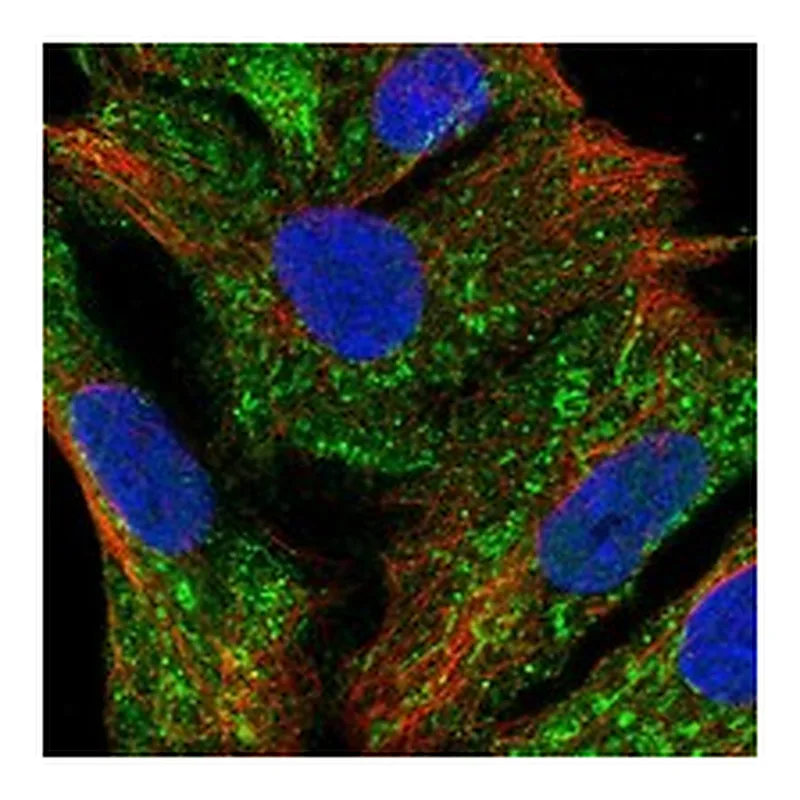 Atlas Antibodies Anti-METTL27 Antibody