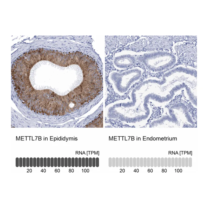 Atlas Antibodies Anti-METTL7B Antibody