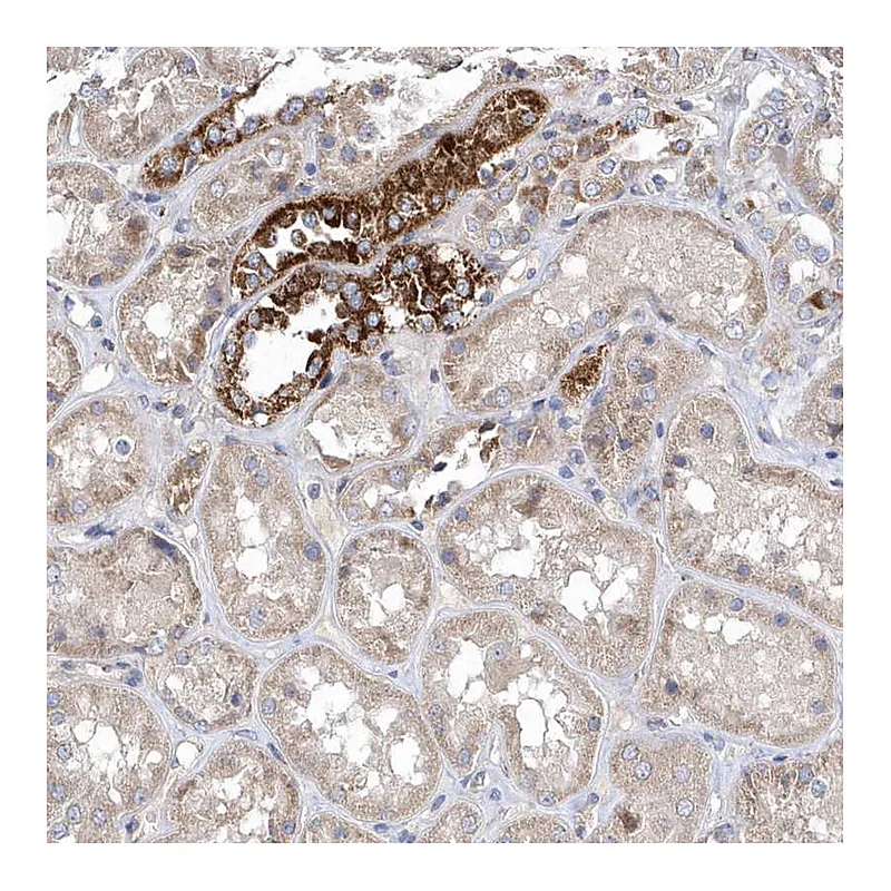 Atlas Antibodies Anti-METTL8 Antibody