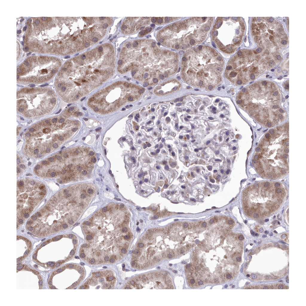 Atlas Antibodies Anti-METTL9 Antibody