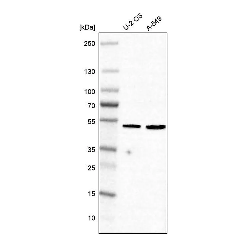 Atlas Antibodies Anti-MEX3A Antibody