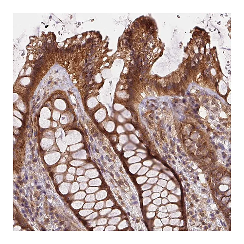 Atlas Antibodies Anti-MEX3D Antibody