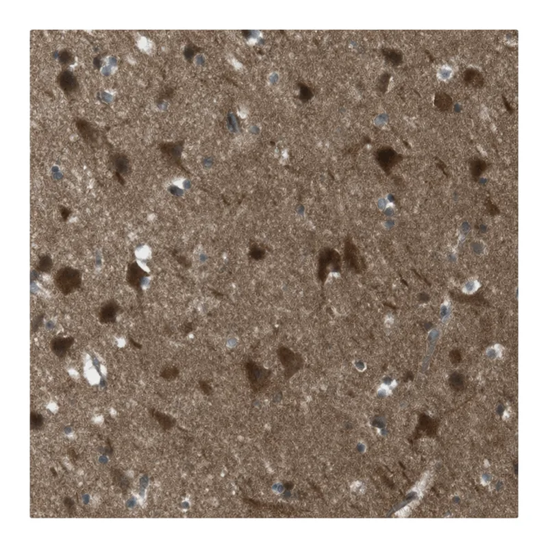 Atlas Antibodies Anti-MFAP3 Antibody