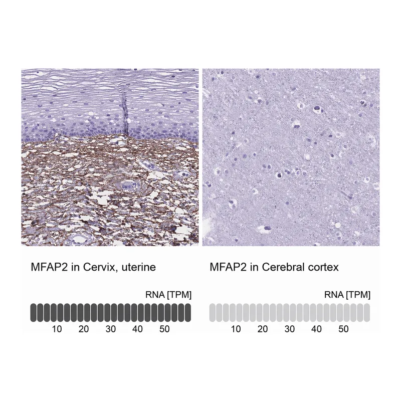 Atlas Antibodies Anti-MFAP2 Antibody