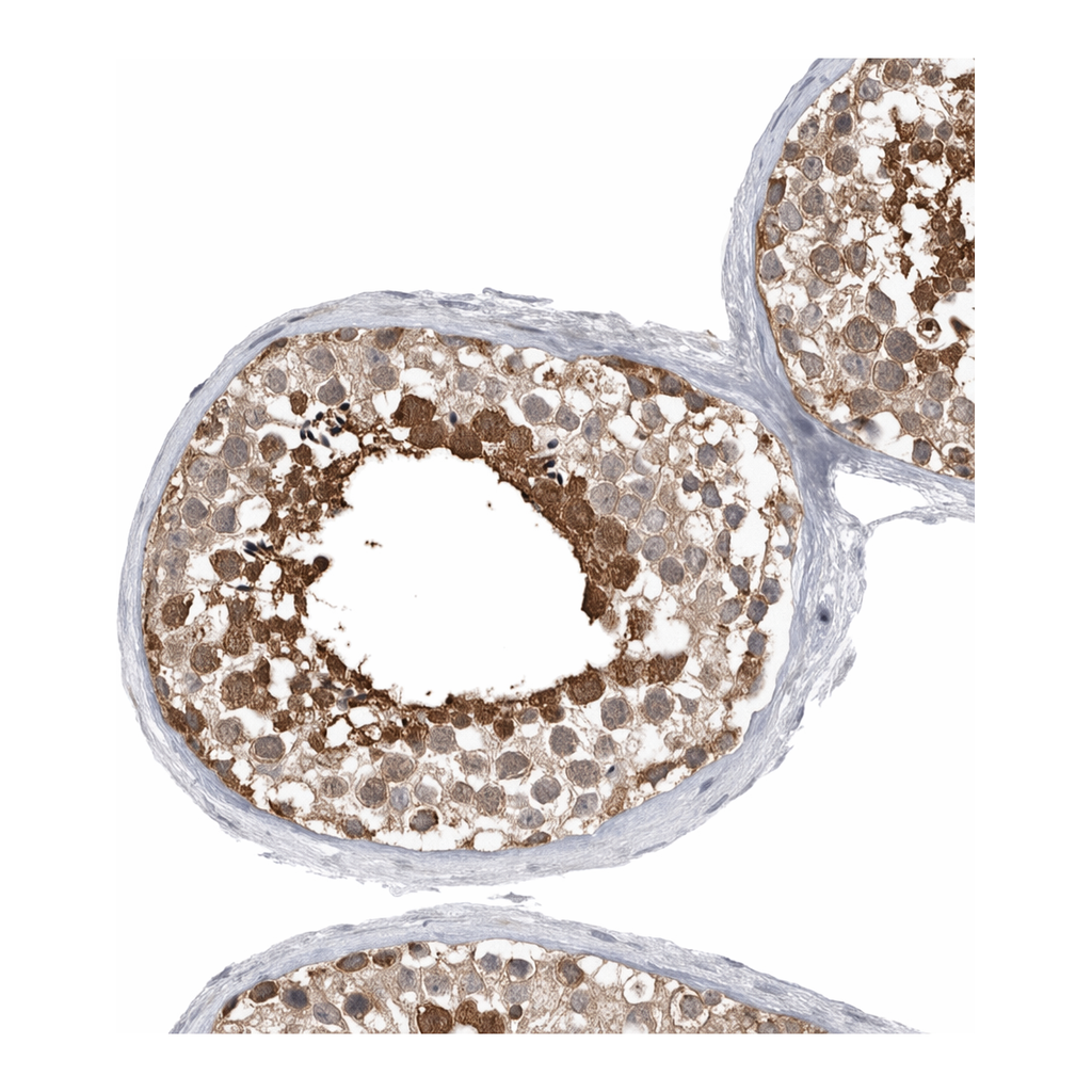 Atlas Antibodies Anti-MFAP3L Antibody