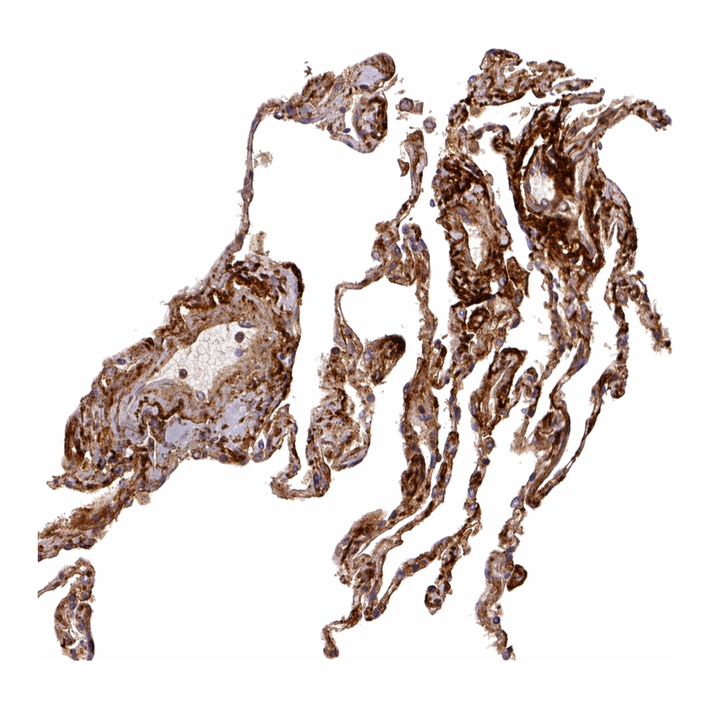 Atlas Antibodies Anti-MFAP4 Antibody