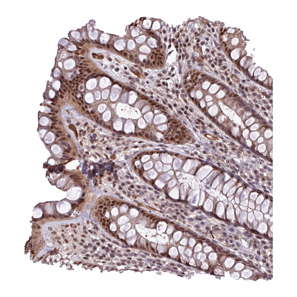 Atlas Antibodies Anti-MFHAS1 Antibody