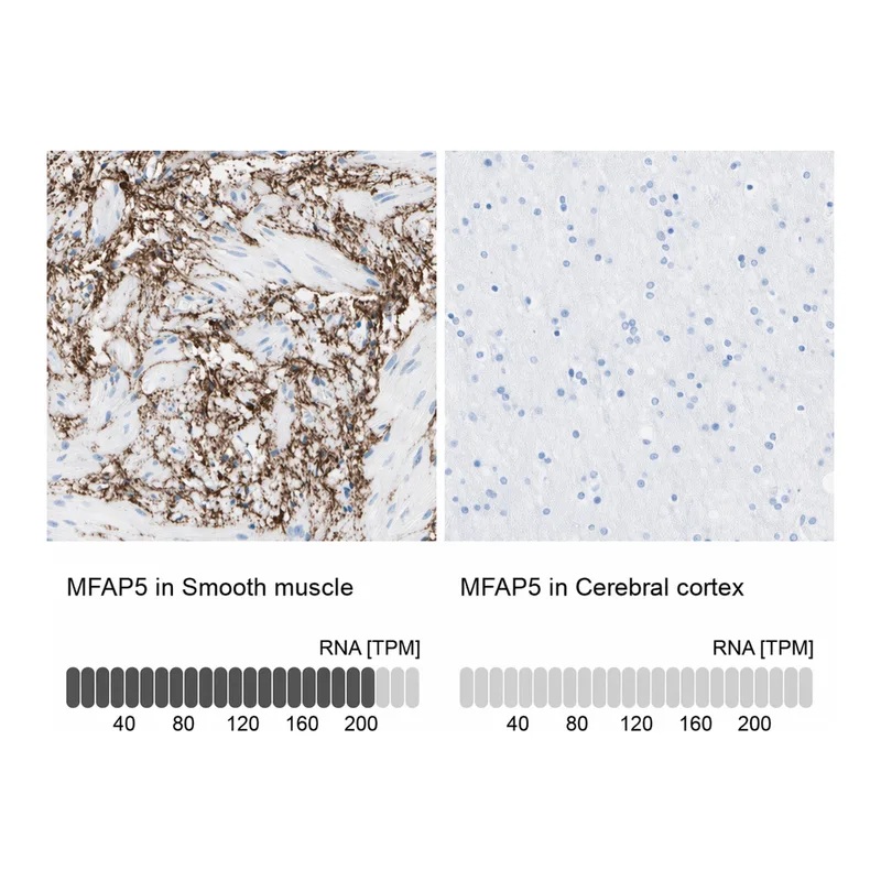 Atlas Antibodies Anti-MFAP5 Antibody