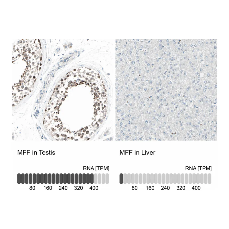 Atlas Antibodies Anti-MFF Antibody