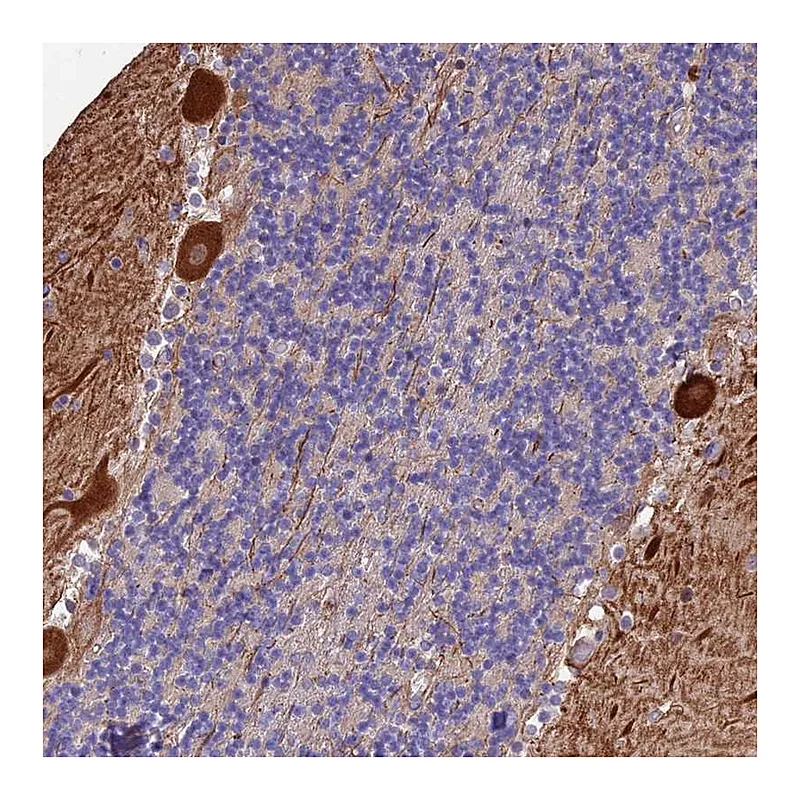 Atlas Antibodies Anti-MFSD2A Antibody