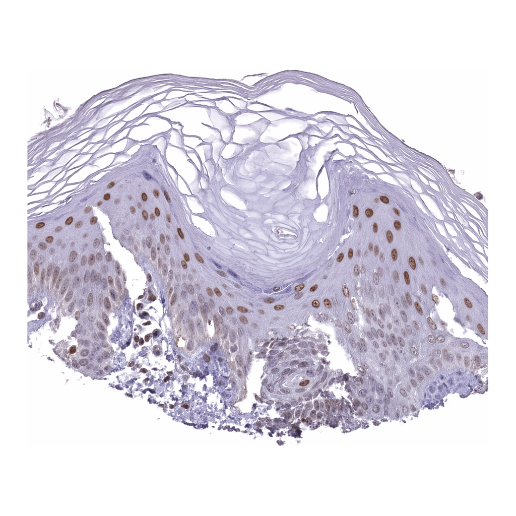 Atlas Antibodies Anti-MFSD12 Antibody