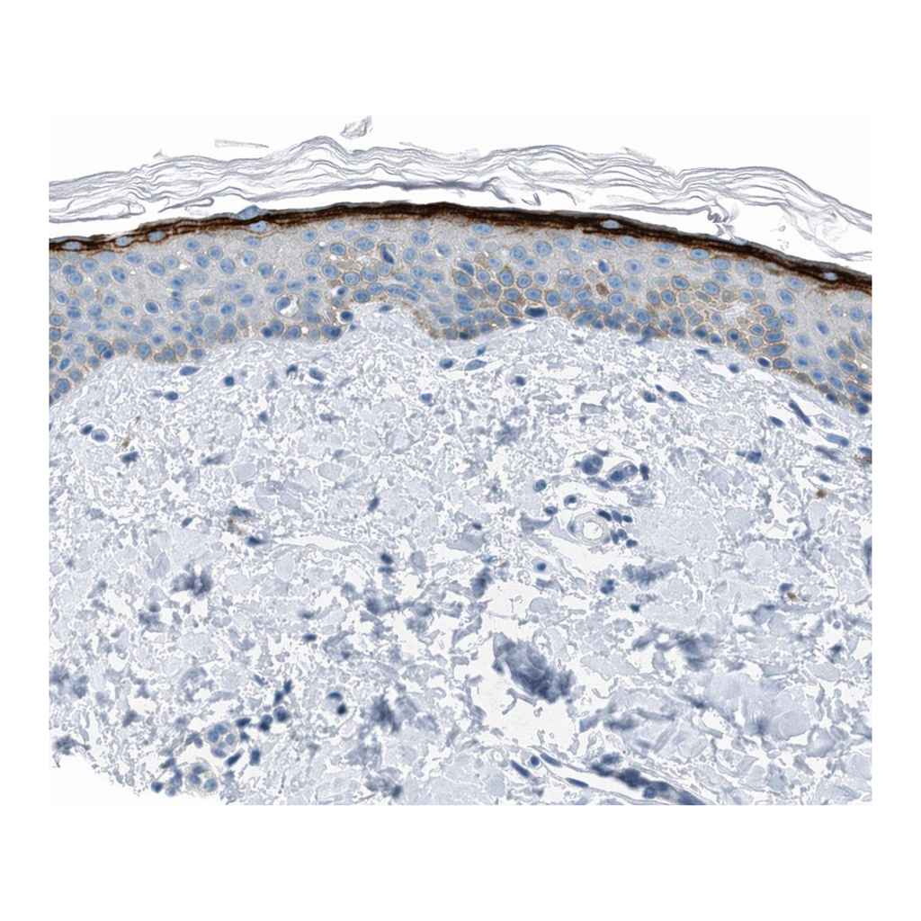 Atlas Antibodies Anti-MFSD13A Antibody