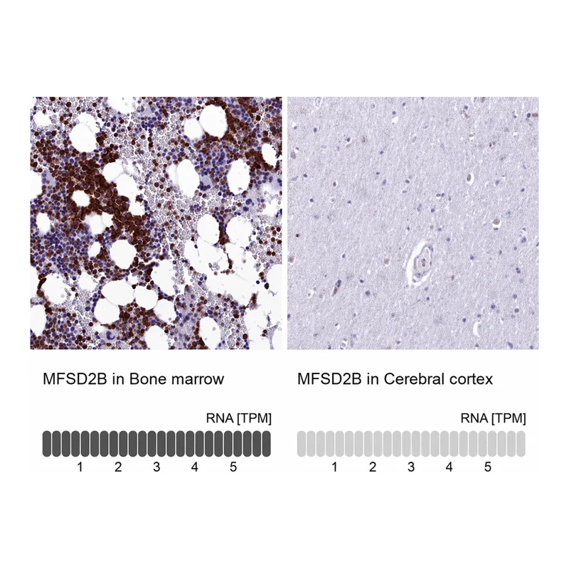 Atlas Antibodies Anti-MFSD2B Antibody