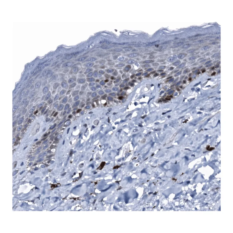 Atlas Antibodies Anti-MFSD5 Antibody