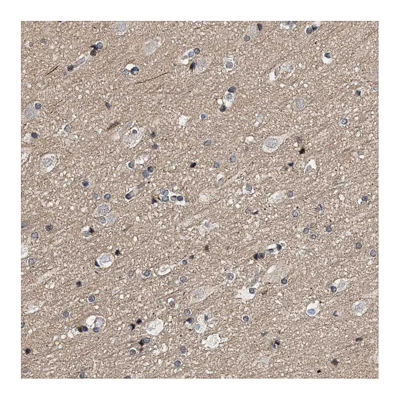 Atlas Antibodies Anti-MFSD6 Antibody