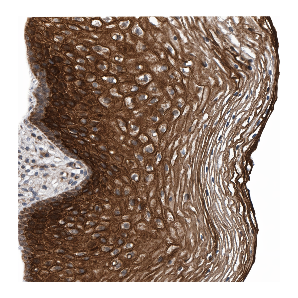 Atlas Antibodies Anti-MFSD6L Antibody