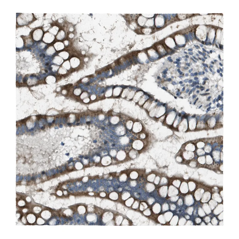 Atlas Antibodies Anti-MGAT3 Antibody