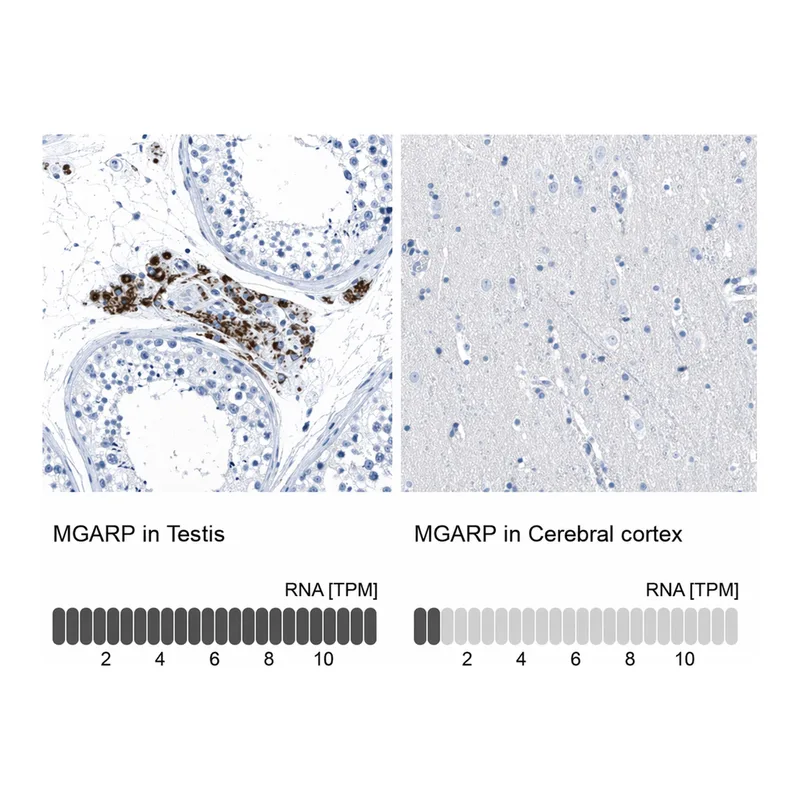 Atlas Antibodies Anti-MGARP Antibody