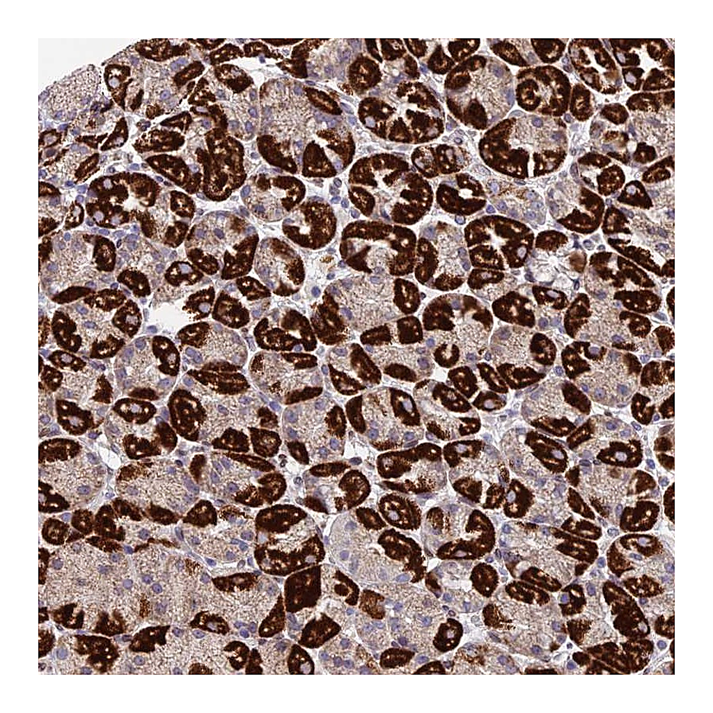 Atlas Antibodies Anti-MGAT2 Antibody